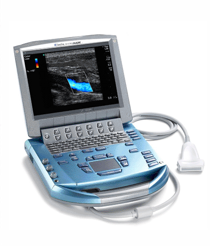 Image: The MicroMaxx portable ultrasound system (photo courtesy SonoSite).